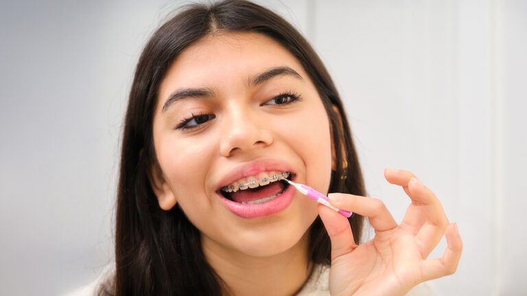 teenage girl flossing her braces